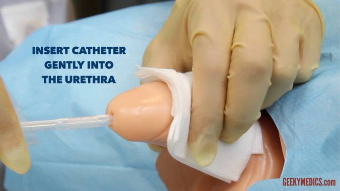 Insert-catheter1